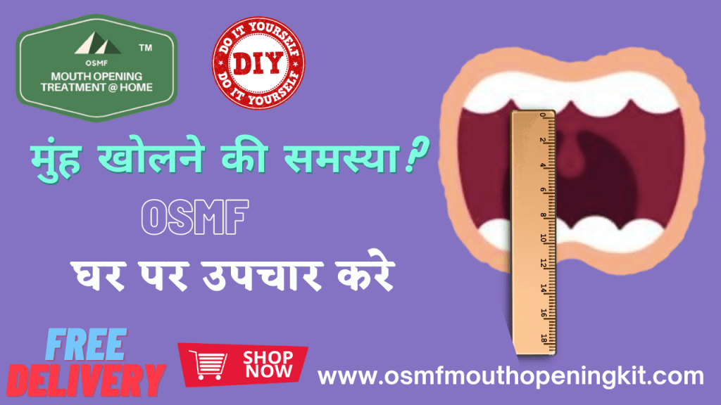 osmf mouth opening treatment kit smile in hour