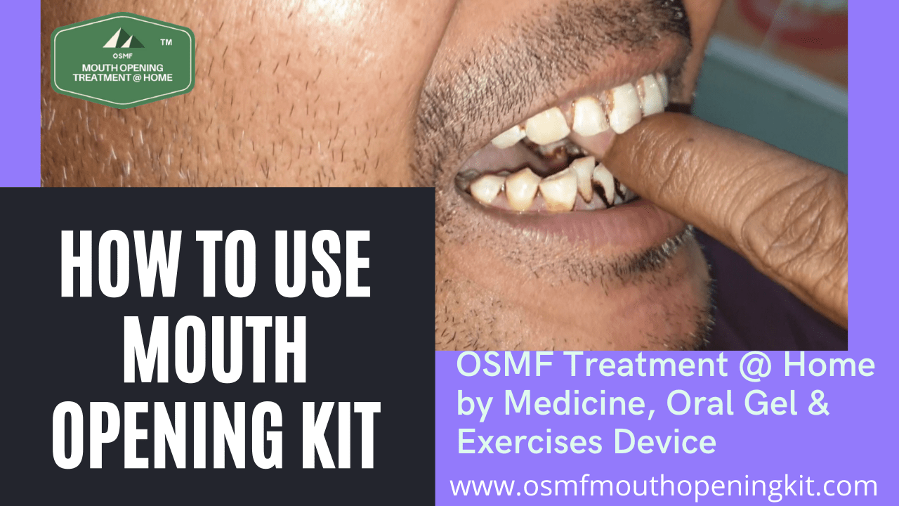 Osmf Mouth Opening treatment Kit  Releases Video Showing How to Use the Mouth Opener DIY Kit at Home