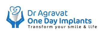 Dr Agravat One Day Implants Clinic Ahmedabad Gujarat India LOGO