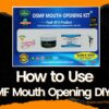 How to use Video OSMF Mouth Opening DIY Kit Pack of 4 Products