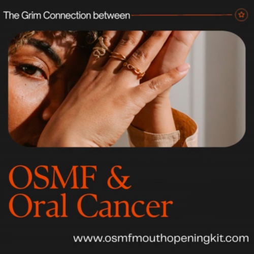 The Grim Connection between Oral Submucous Fibrosis OSMF and Mouth Cancer
