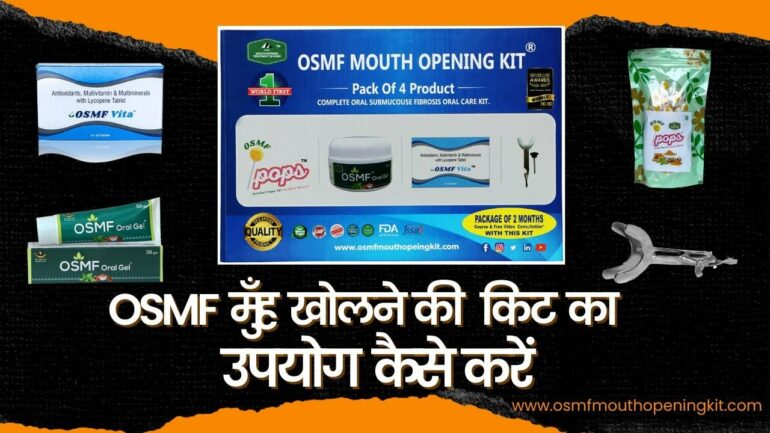 Video thumbnail for youtube video ymra9u6r6ge