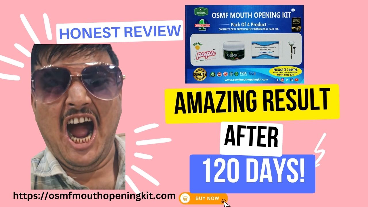 Result After Using 120 days OSMF Mouth Opening DIY Kit Honest Review