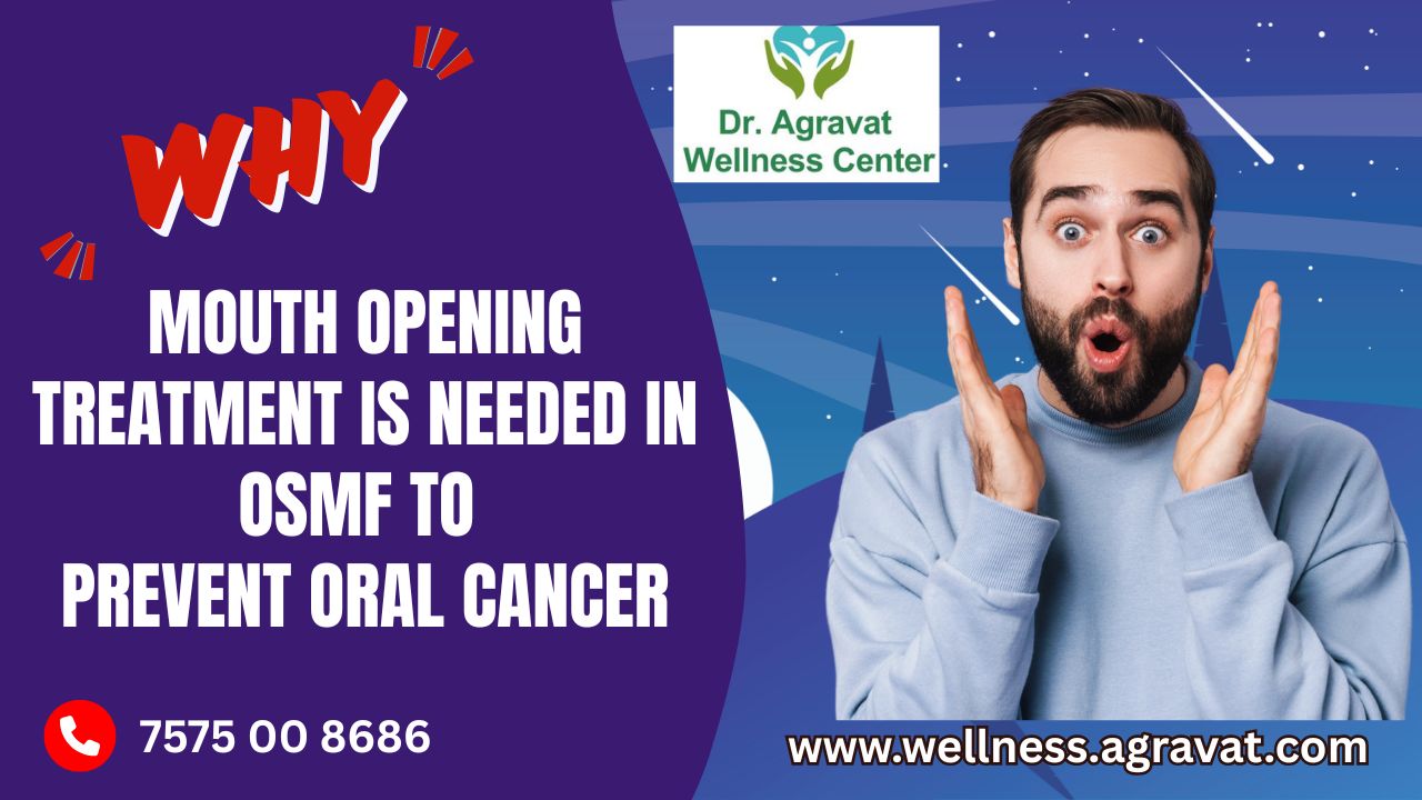 Why Mouth Opening Treatment needed in OSMF to Prevent Oral Cancer At Dr Agravat Wellness Center, Ahmedabad, Gujarat, India
