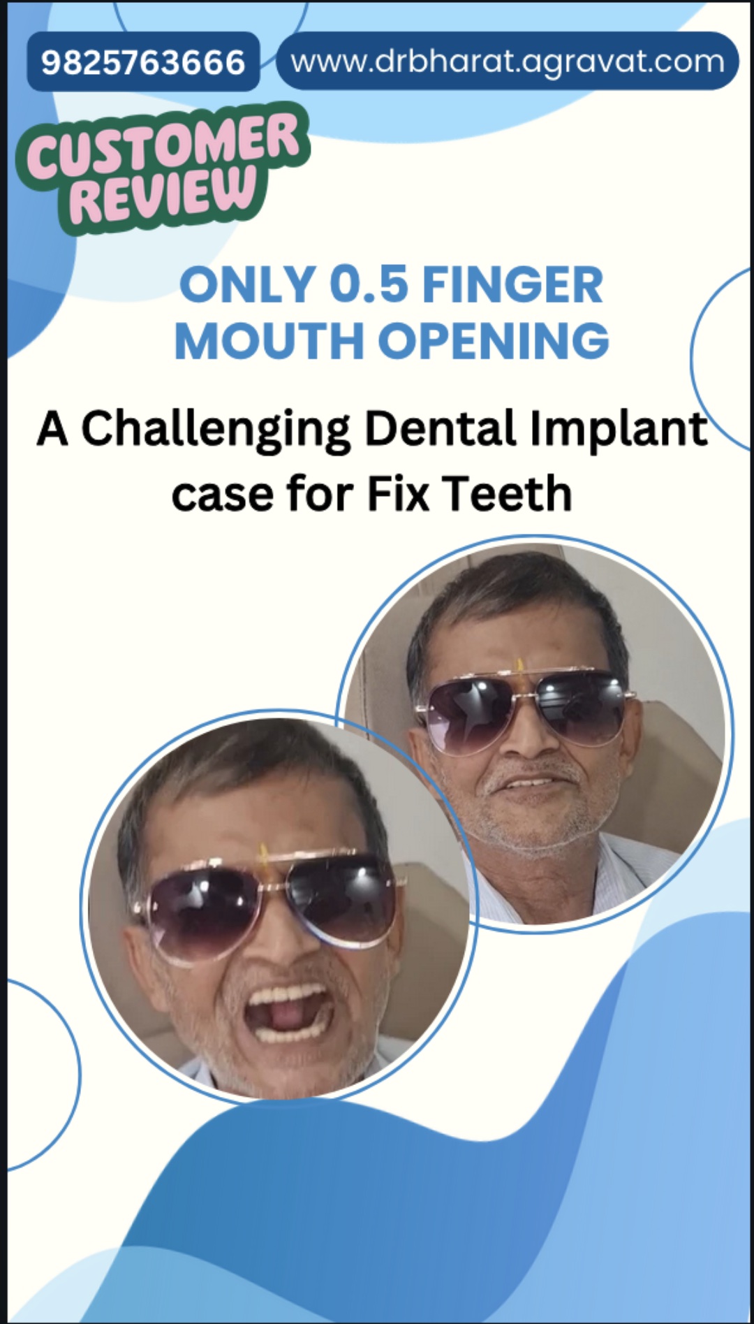Mouth Opening Success with OLI Therapy & Fixed Teeth by Dental Implants | Dr. Bharat Agravat Patient Video Review