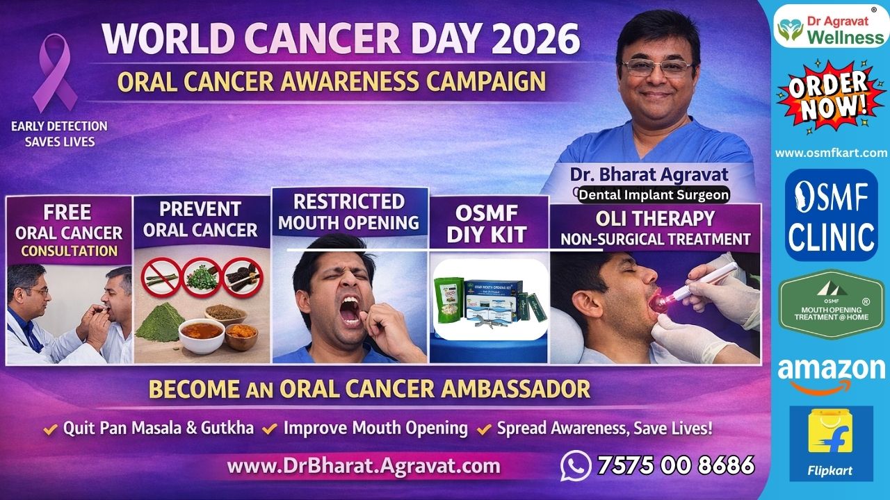 On World Cancer Day 2026, Dr. Bharat Agravat Highlights Proven OSMF Mouth Opening DIY Kits and Non-Surgical OLI Therapy for Oral Cancer Prevention
