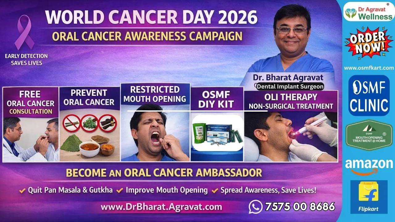 On World Cancer Day 2026, Dr. Bharat Agravat Highlights Proven OSMF Mouth Opening DIY Kits and Non-Surgical OLI Therapy for Oral Cancer Prevention
